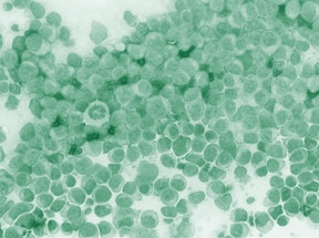 Citometría de flujo