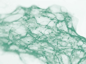 Citopatología e Histopatología