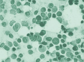 Hematología y coagulación