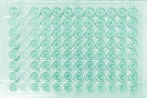 Pruebas serológicas y biología molecular para enfermedades infecciosas 