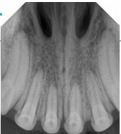 image BEST%20X%20DC%203