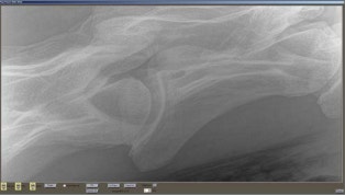 image POTRO%20DR%204